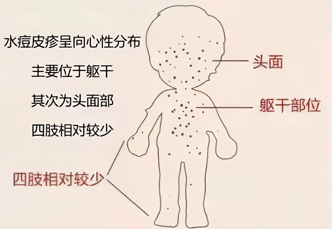 101824edfzf2gkidfbkc9i.png